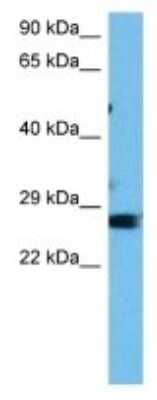 Western Blot: Glutathione S-Transferase pi 1/GSTP1 Antibody [NBP3-10136]