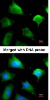Immunocytochemistry/ Immunofluorescence: Glutathione S-transferase Mu 5 Antibody [NBP1-32682]