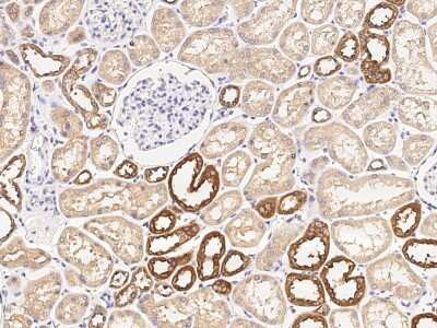 Immunohistochemistry-Paraffin: Glutathione S-transferase Mu 5 Antibody [NBP2-97064]
