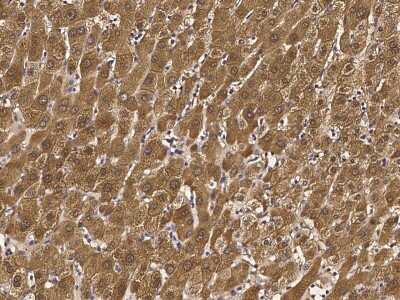 Immunohistochemistry-Paraffin: Glutathione S-transferase Mu 5 Antibody [NBP2-97064]