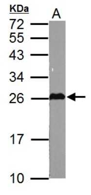 Western Blot: Glutathione S-transferase Mu 5 Antibody [NBP1-32682]