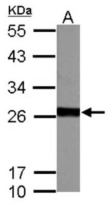 Western Blot: Glutathione S-transferase Mu 5 Antibody [NBP1-32682]