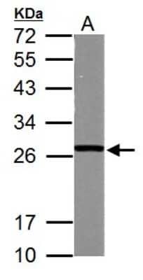 Western Blot: Glutathione S-transferase Mu 5 Antibody [NBP2-16687]