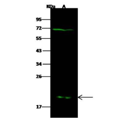 Western Blot: Glutathione S-transferase Mu 5 Antibody [NBP2-97064]