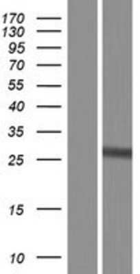 Western Blot: Glutathione S-transferase Mu 5 Overexpression Lysate [NBP2-10709]