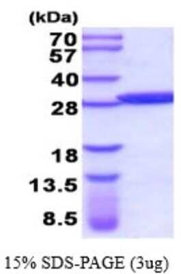 SDS-PAGE: Recombinant Human Glutathione S-transferase Mu 5 His Protein [NBP2-52145]