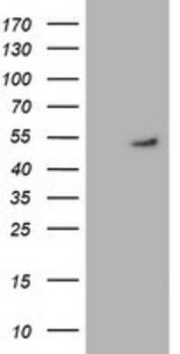 Western Blot: Glutathione Synthetase Antibody (OTI1B8) [NBP2-03351]