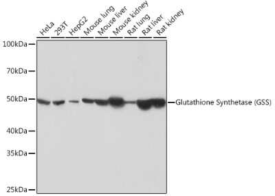 Western Blot: Glutathione Synthetase Antibody (2S9W7) [NBP3-15402]