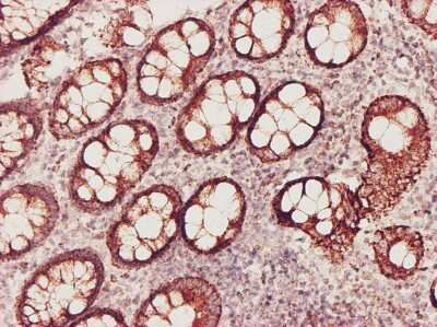 Immunohistochemistry-Paraffin: Glutathione Synthetase Antibody (4B6) [H00002937-M03]