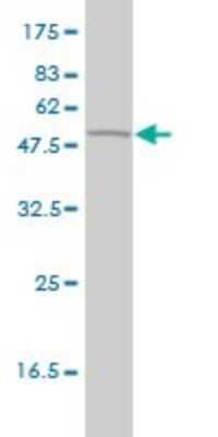 Western Blot: Glutathione Synthetase Antibody (5G4-2E9) [H00002937-M01]