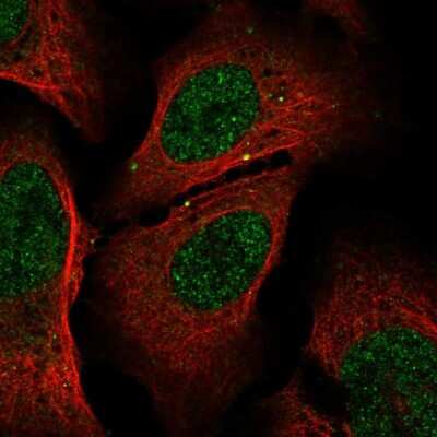 Immunocytochemistry/ Immunofluorescence: Glutathione Synthetase Antibody [NBP2-30465]