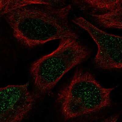 Immunocytochemistry/ Immunofluorescence: Glutathione Synthetase Antibody [NBP2-57177]
