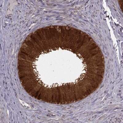 Immunohistochemistry-Paraffin: Glutathione Synthetase Antibody [NBP2-30465]