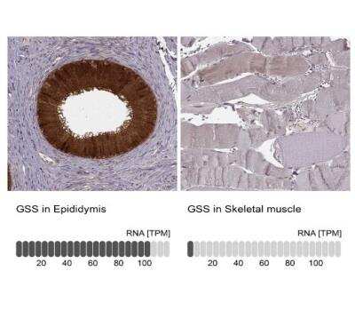 Immunohistochemistry-Paraffin: Glutathione Synthetase Antibody [NBP2-30465]