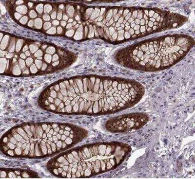 Immunohistochemistry-Paraffin: Glutathione Synthetase Antibody [NBP2-30465]