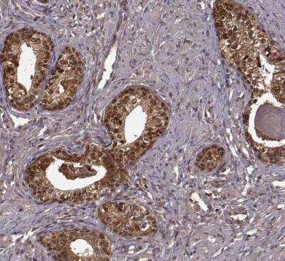 Immunohistochemistry-Paraffin: Glutathione Synthetase Antibody [NBP2-30465]