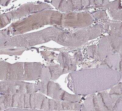 Immunohistochemistry-Paraffin: Glutathione Synthetase Antibody [NBP2-30465]