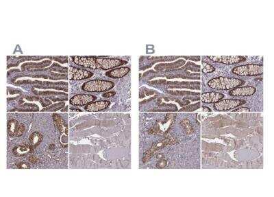 Immunohistochemistry-Paraffin: Glutathione Synthetase Antibody [NBP2-30465]