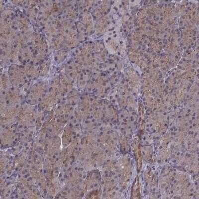 Immunohistochemistry-Paraffin: Glutathione Synthetase Antibody [NBP2-57177]