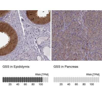 Immunohistochemistry-Paraffin: Glutathione Synthetase Antibody [NBP2-57177]