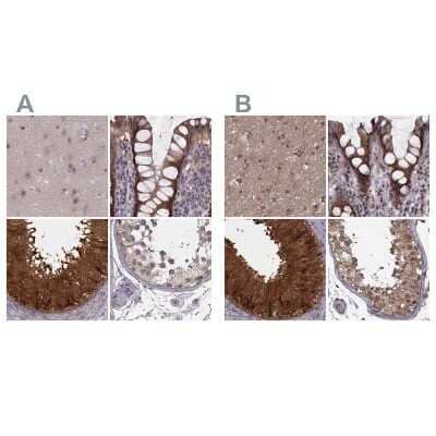 Immunohistochemistry-Paraffin: Glutathione Synthetase Antibody [NBP2-57177]