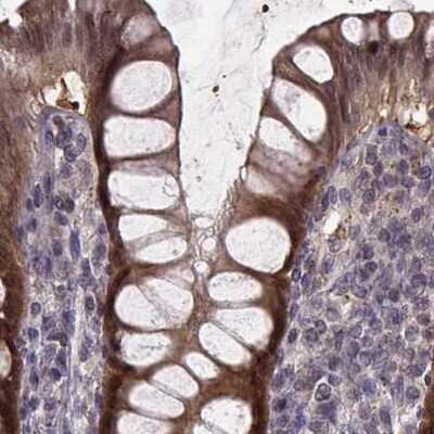 Immunohistochemistry-Paraffin: Glutathione Synthetase Antibody [NBP2-57177]
