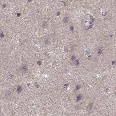 Immunohistochemistry-Paraffin: Glutathione Synthetase Antibody [NBP2-57177]