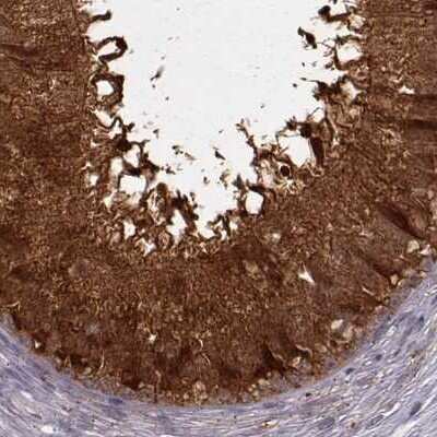 Immunohistochemistry-Paraffin: Glutathione Synthetase Antibody [NBP2-57177]