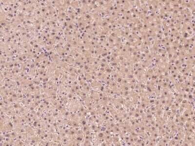 Immunohistochemistry-Paraffin: Glutathione Synthetase Antibody [NBP2-99590]