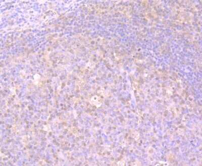 Immunohistochemistry-Paraffin: Glutathione Synthetase Antibody (JB95-33) [NBP2-75513]