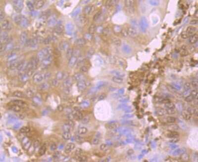 Immunohistochemistry-Paraffin: Glutathione Synthetase Antibody (JB95-33) [NBP2-75513]