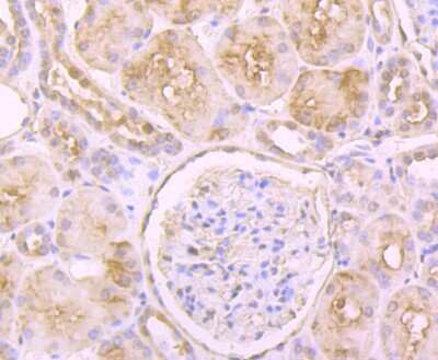 Immunohistochemistry-Paraffin: Glutathione Synthetase Antibody (JB95-33) [NBP2-75513]