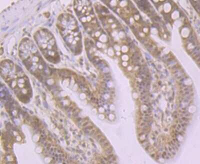 Immunohistochemistry-Paraffin: Glutathione Synthetase Antibody (JB95-33) [NBP2-75513]