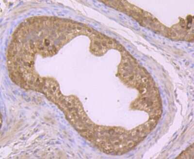 Immunohistochemistry-Paraffin: Glutathione Synthetase Antibody (JB95-33) [NBP2-75513]