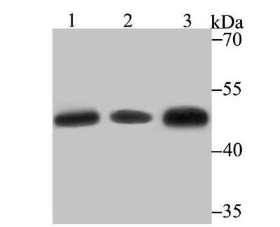 Western Blot: Glutathione Synthetase Antibody (JB95-33) [NBP2-75513]