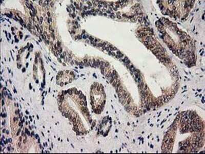 Immunohistochemistry: Glutathione Synthetase Antibody (OTI1B8) - Azide and BSA Free [NBP2-70854]