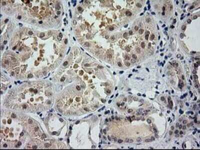 Immunohistochemistry: Glutathione Synthetase Antibody (OTI1B8) - Azide and BSA Free [NBP2-70854]