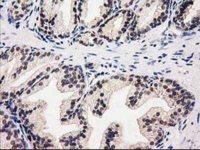 Immunohistochemistry: Glutathione Synthetase Antibody (OTI1B8) - Azide and BSA Free [NBP2-70854]