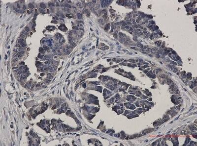 Immunohistochemistry-Paraffin: Glutathione Synthetase Antibody (S07-2B0) [NBP3-19867]