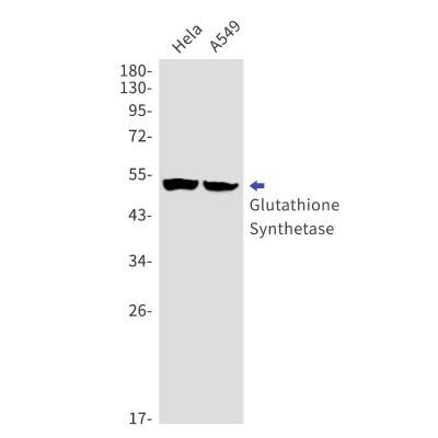 Western Blot: Glutathione Synthetase Antibody (S07-2B0) [NBP3-19867]