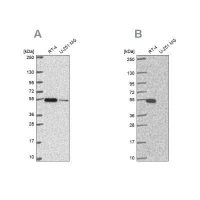 Western Blot: Glutathione Synthetase Antibody [NBP2-30465]