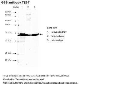 Western Blot: Glutathione Synthetase AntibodyAzide and BSA Free [NBP3-03702]