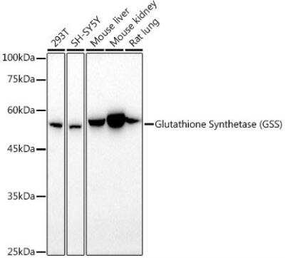 Western Blot: Glutathione Synthetase AntibodyAzide and BSA Free [NBP3-03702]