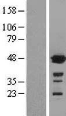 Western Blot: Glutathione Synthetase Overexpression Lysate [NBL1-11365]