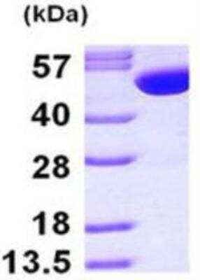 SDS-PAGE: Recombinant Human Glutathione Synthetase His Protein [NBP1-50862]