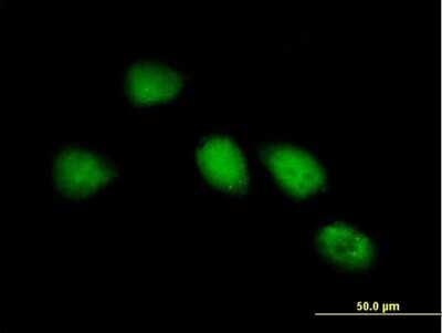 Immunocytochemistry/ Immunofluorescence: GlyBP Antibody [H00009731-B01P]