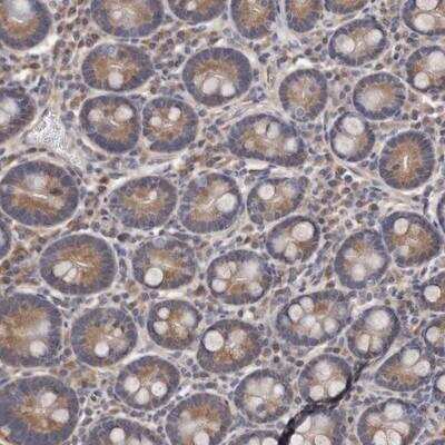 Immunohistochemistry-Paraffin: GlyBP Antibody [NBP1-84540]