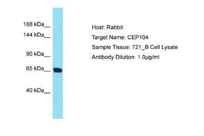 Western Blot: GlyBP Antibody [NBP2-84987]