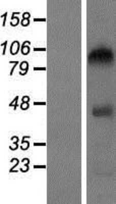 Western Blot: GlyBP Overexpression Lysate [NBP2-10308]