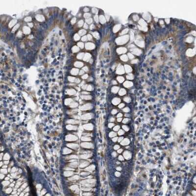 Immunohistochemistry-Paraffin: GlyT1/SLC6A9 Antibody [NBP1-81820]